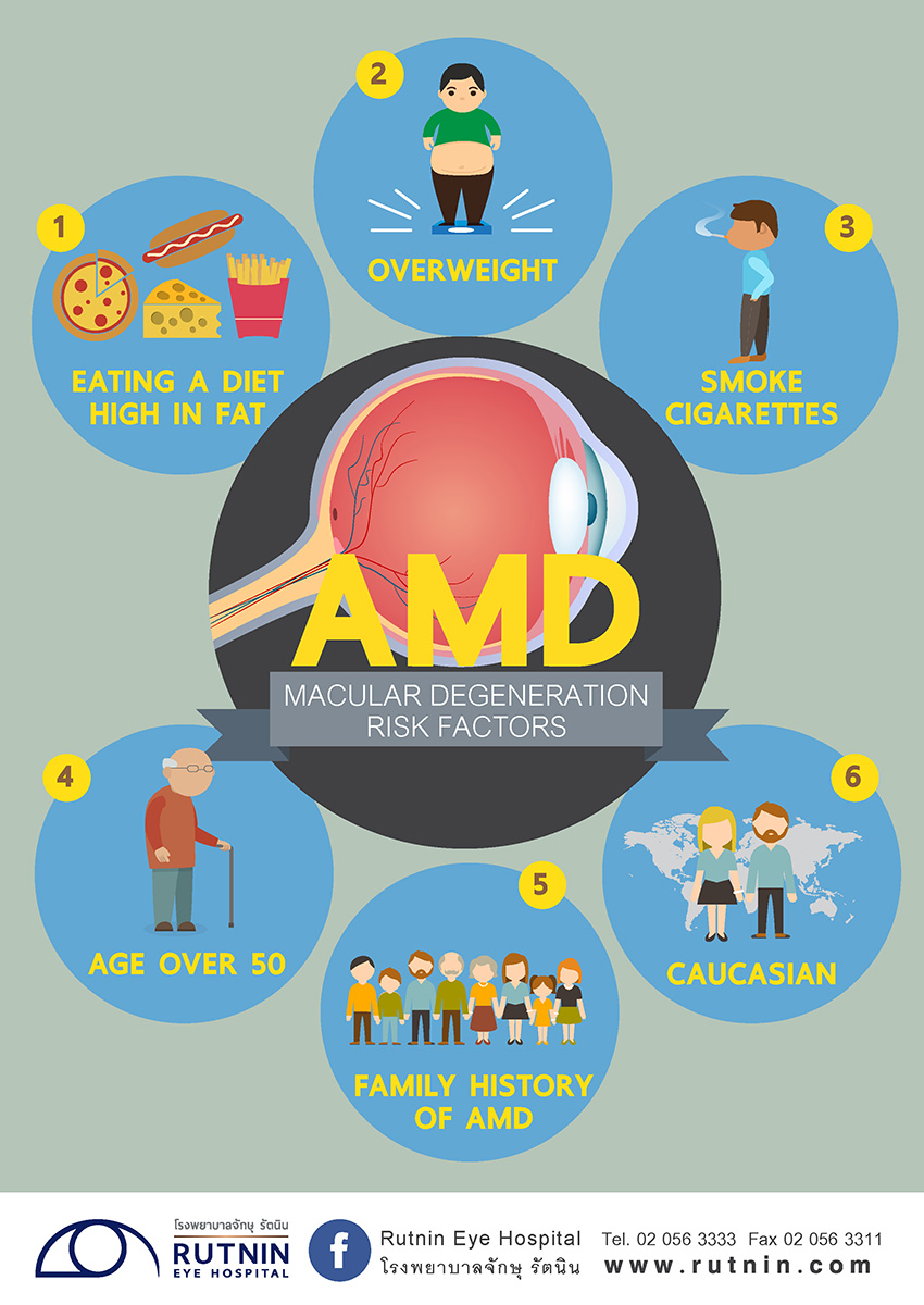 Macular degeneration risk factors AMD