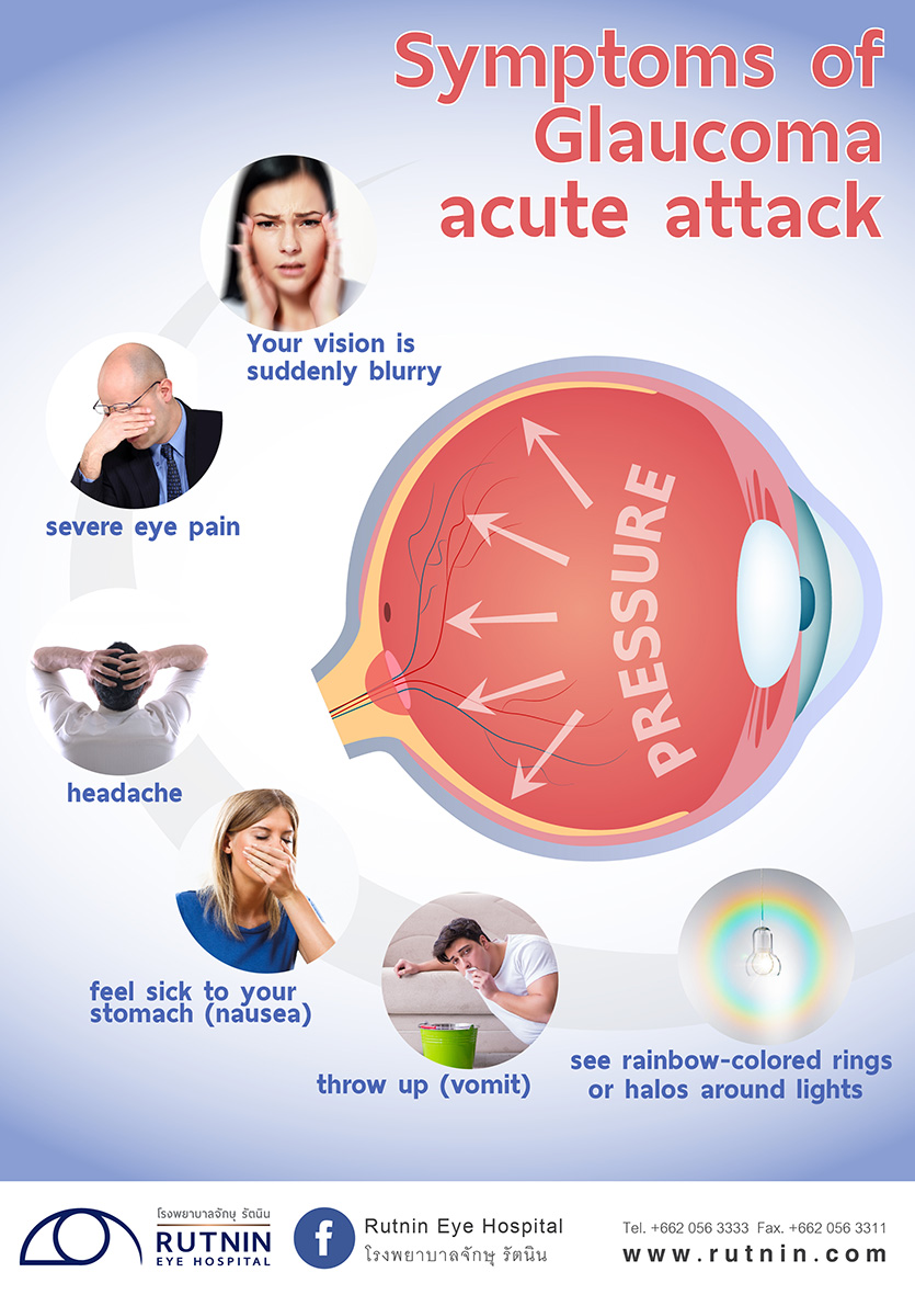 Symptoms of Glaucoma acute attack