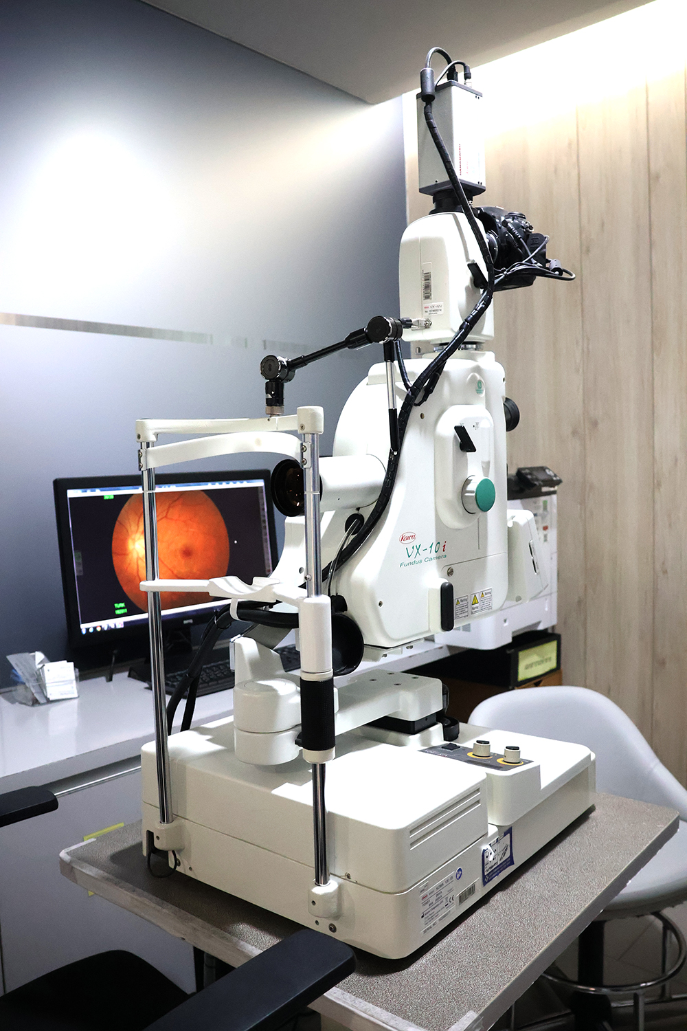 Stereo Fundus Camera (3 DX)